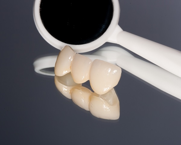 When Would A Dentist Recommend Dental Bridges?