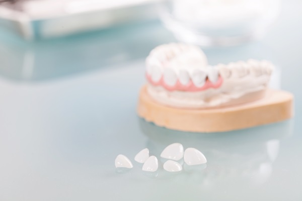 How Dental Veneers Can Boost Your Confidence