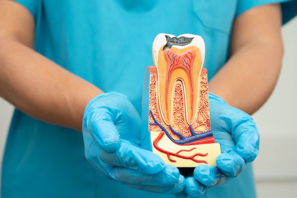 Root Canals Explained: What Patients Should Know Before Treatment